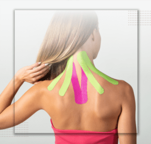 kinesio tape és fascia